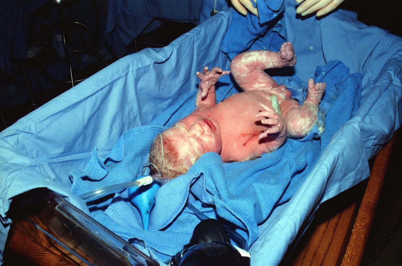 A newborn baby is cared for moments after birth in a hospital environment.