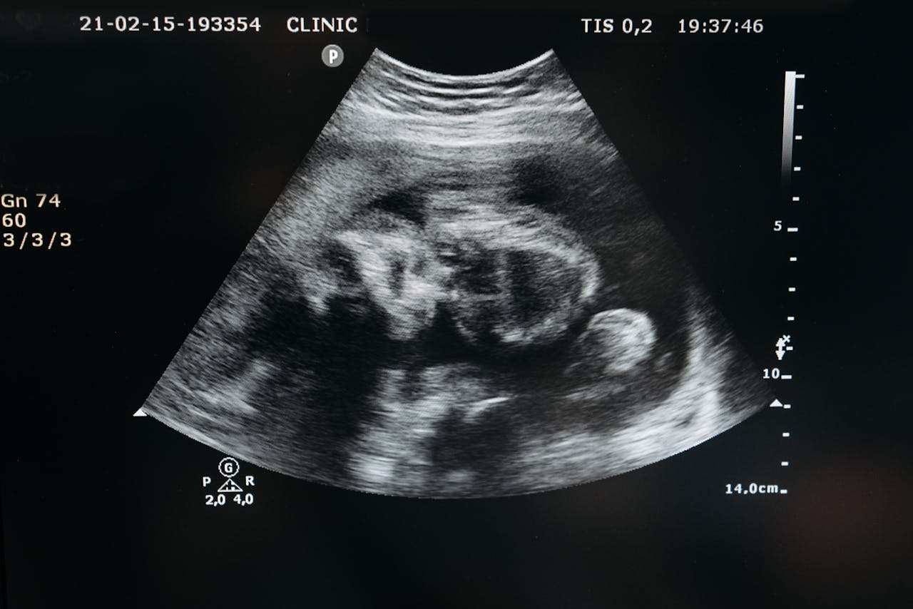 Ultrasound scan showing the image of an unborn child in the womb, highlighting pregnancy and healthcare.